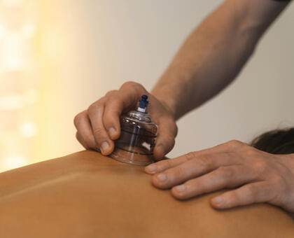 Cupping